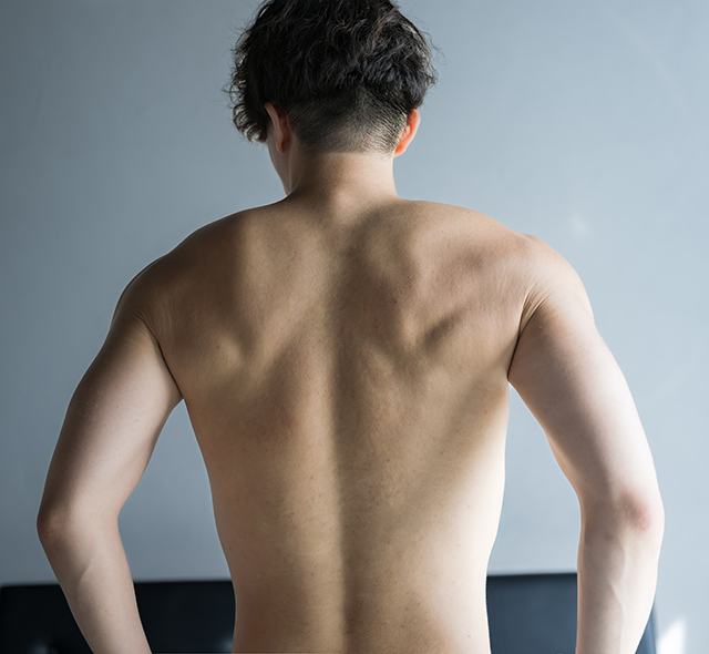 男性医療脱毛