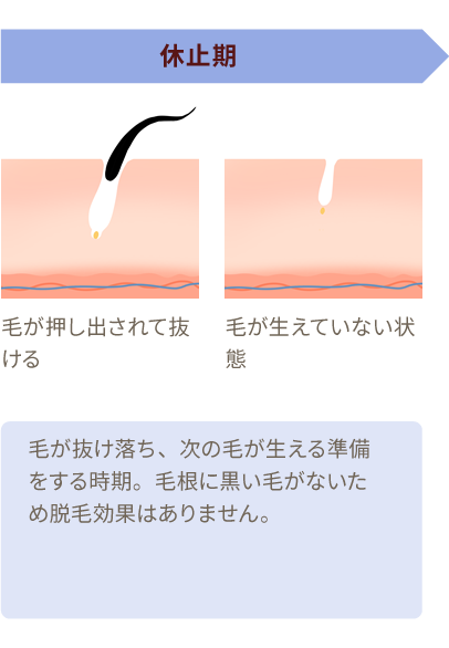 休止期