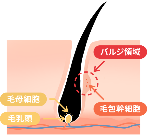 医療レーザー脱毛の仕組み１